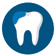 composite-fillings
